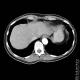 Thorax 49
